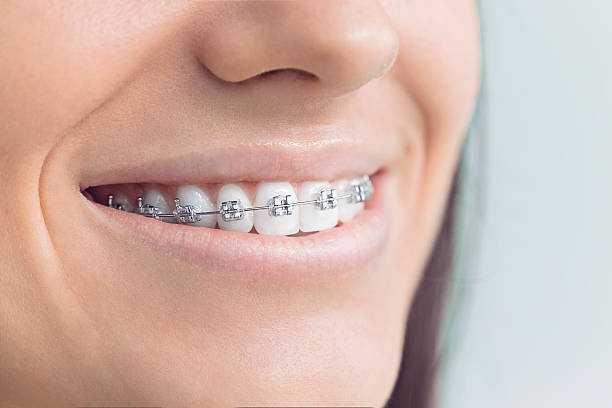 Best Dental Bonding  in Willard, MO